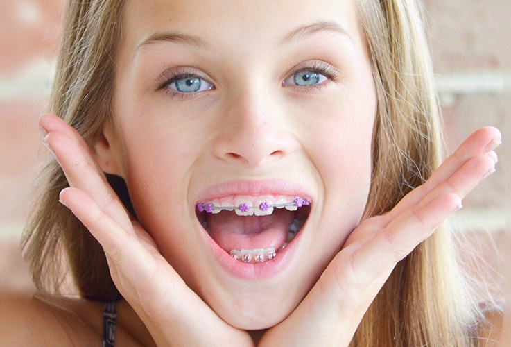 Girl showing off her braces